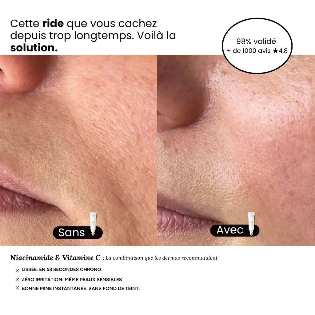 Lisseur de ride instantanée – effet lissant