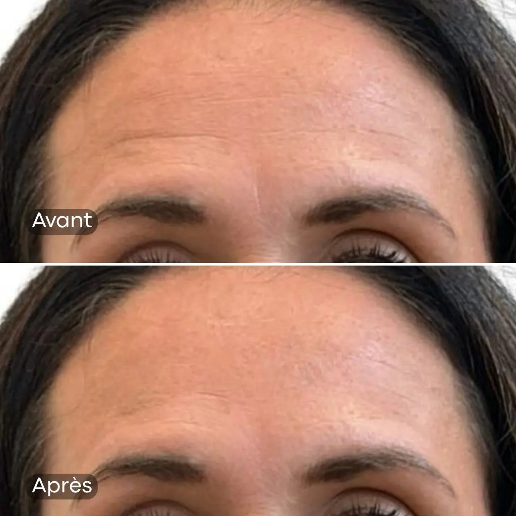 Lisseur de ride instantanée – effet lissant