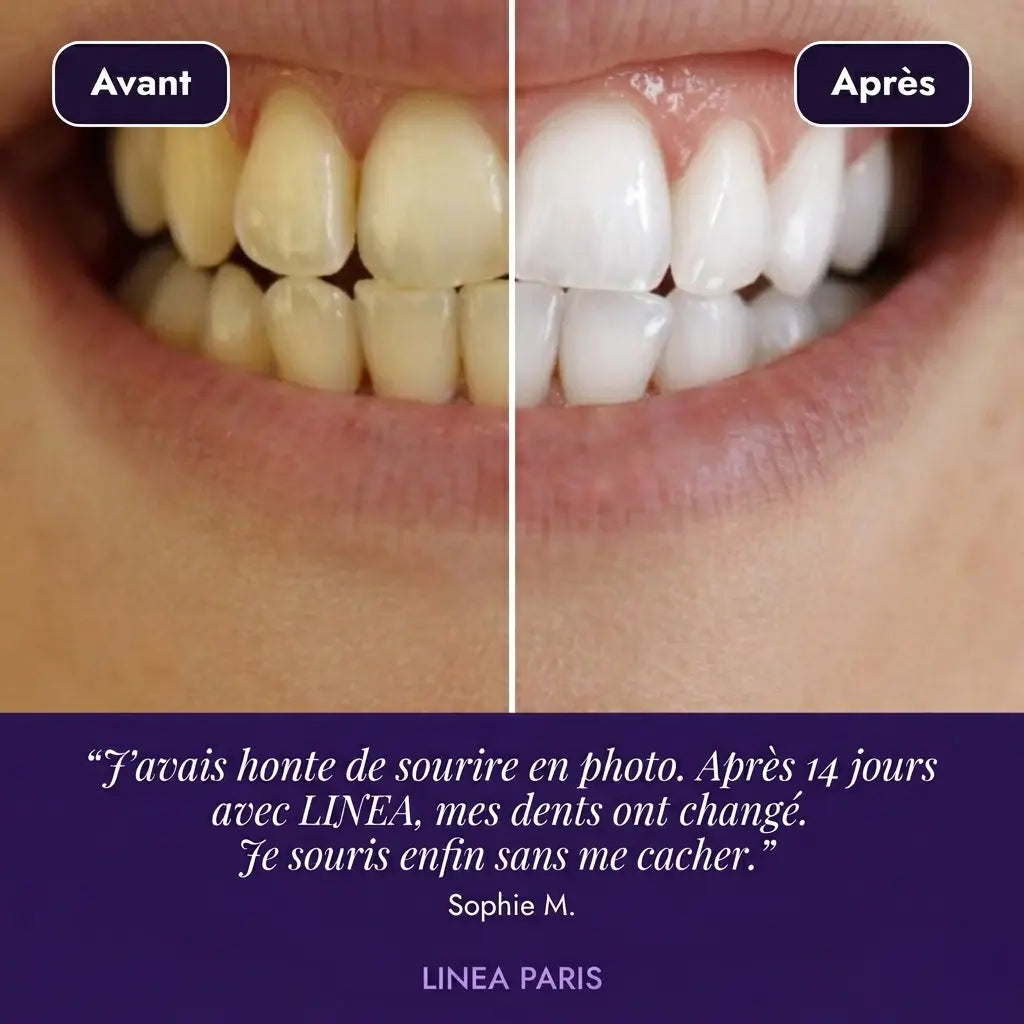 Bandes blanchissantes - LINEA PARIS