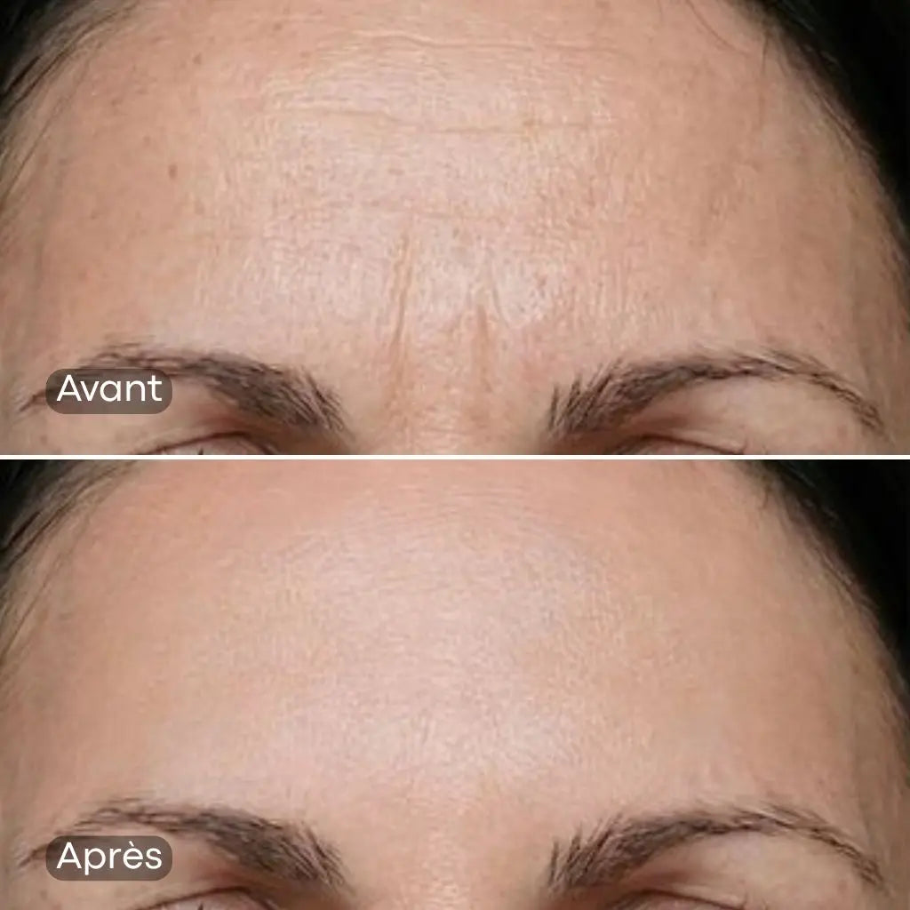 Lisseur de ride instantanée LINEA — effet visible en 58 secondes