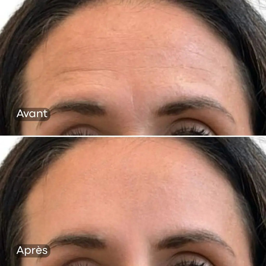 Lisseur de ride instantanée LINEA — effet visible en 58 secondes